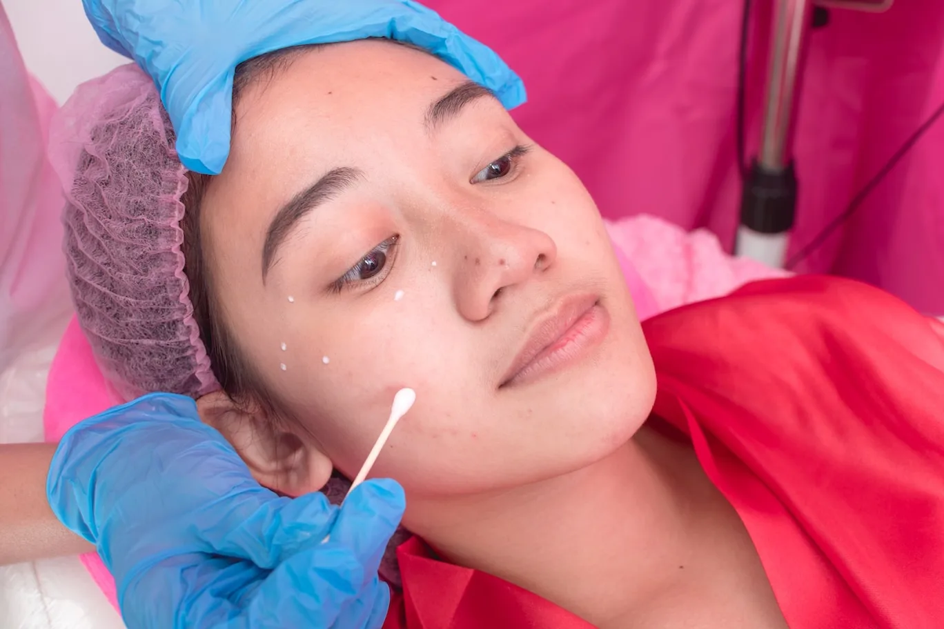 Image of woman having numbing cream applied to her face.